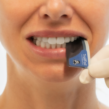 Ultra-thin TrollFoil™ strips for precise occlusal contact marking on wet or dry teeth, Clinical image
