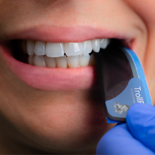 Ultra-thin TrollFoil™ strips for precise occlusal contact marking on wet or dry teeth, Clinical image