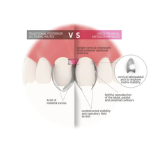 Unica Proximal Anterior Matrices Matrix Systems