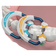 Strata-G™ Sectional Matrix System