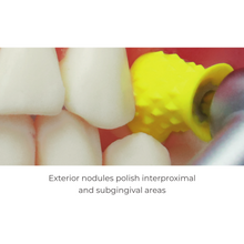 Premium Plus™ Short Prophy Cups are latex-free, have a turbine blade design for reduced splatter. Snap-on type. Clinical photo.