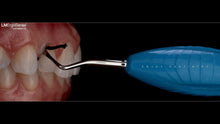 LM Cord Packer | Curion Dental