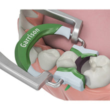 Composi-Tight® 3D Fusion™ Ring | Curion Dental