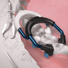 NiTin™ Matrix Rings | Curion Dental