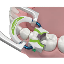 Strata-G™ Matrix Rings - Nitinol Wire for Durability & Strength, Wide Prep Ring