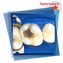 Sanctuary™ Non-Latex Dental Dams, Clinical Image