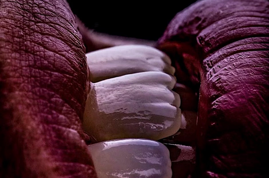 Anterior Veneer Aesthetics Mastership: Live Patient Experience