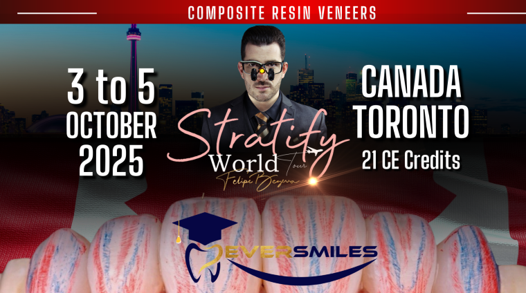 Facettes en résine composite Stratifier le monde (Toronto) octobre 2025 - Eversmiles