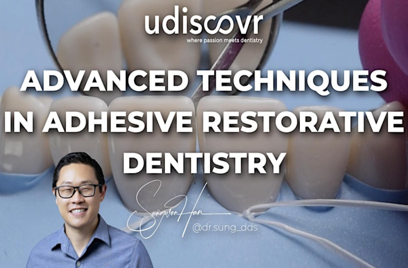 Techniques avancées en dentisterie restauratrice adhésive