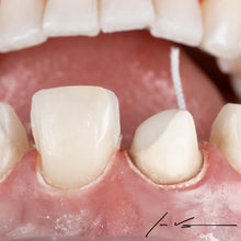 Curion_Dental_ProPak™ Plain Retraction Cord