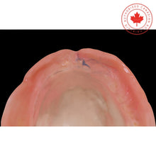 Hydent® pour l'indication du point haut des prothèses dentaires | Curion Dental