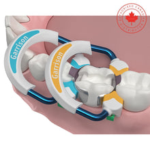 Strata-G™ Sectional Matrix System | Curion Dental