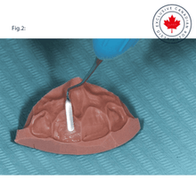 LM-Arte™ Applica Twist | Curion Dental