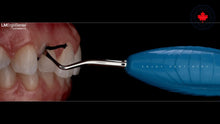 LM Cord Packer | Curion Dental