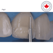 LM-Arte™ Misura | Curion Dental