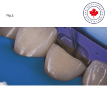 LM-Arte™ Fissura | Curion Dental