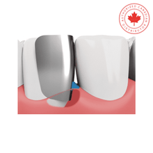 Fusion™ Anterior Bands | Curion Dental