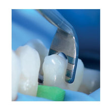 LM-Arte™ Cusp Misura | Curion Dental