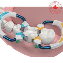 Anneaux Strata-G™ | Curion Dental