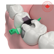 Strata-G™ Wedges | Curion Dental